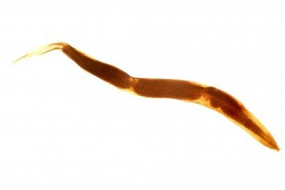 BADANIE KRWI NA OBECNOŚĆ PASOŻYTÓW