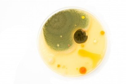 BADANIA NA OBECNOŚĆ GRZYBÓW W ORGANIŹMIE